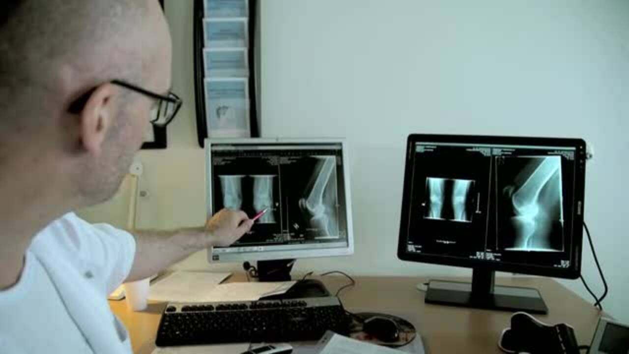 Røntgen for at vurdere graden af artrose i knæet